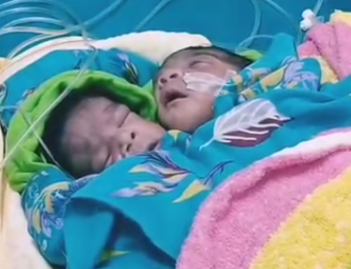 নওগাঁয় দুই মাথা তিন হাতওয়ালা শিশুর জন্ম